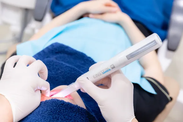 大手町の歯科｜口腔内CCDカメラ