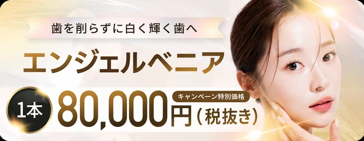 大手町の歯科｜エンジェルベニア キャンペーン