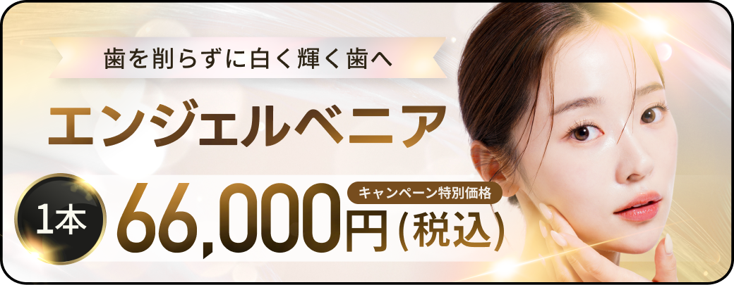 エンジェルベニア キャンペーン