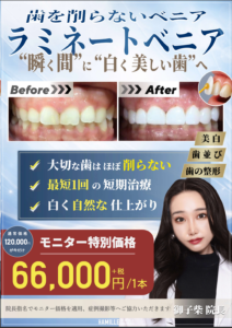 【4月スタート】歯を削らない「ラミネートベニア」特別モニター募集のお知らせ