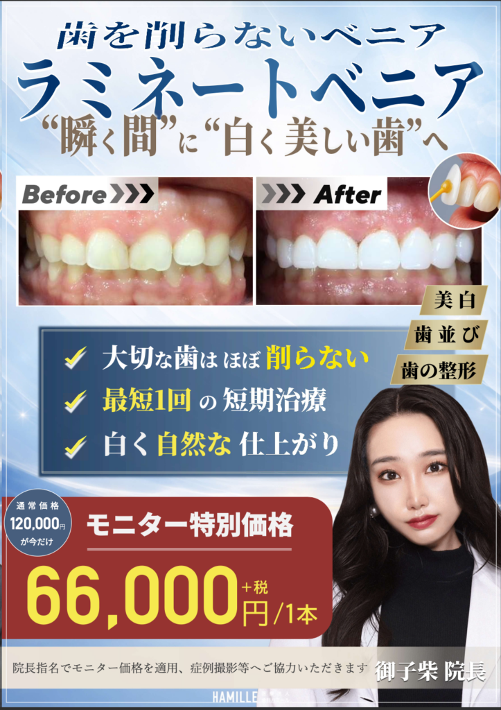 【4月スタート】歯を削らない「ラミネートベニア」特別モニター募集のお知らせ