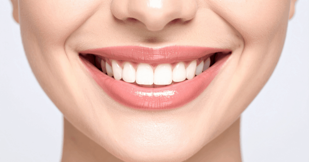 審美セラミック治療に向いている人