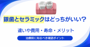 銀歯とセラミックはどっちがいい？違いや費用・寿命・メリットを比較して解説｜大手町の歯医者 ハミール東京デンタルオフィスの歯科コラム